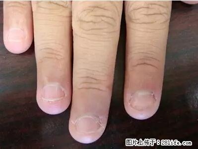 剪指甲、挖耳屎，这些日常小动作竟隐藏大危害！ - 东营生活资讯 - 东营28生活网 dy.28life.net